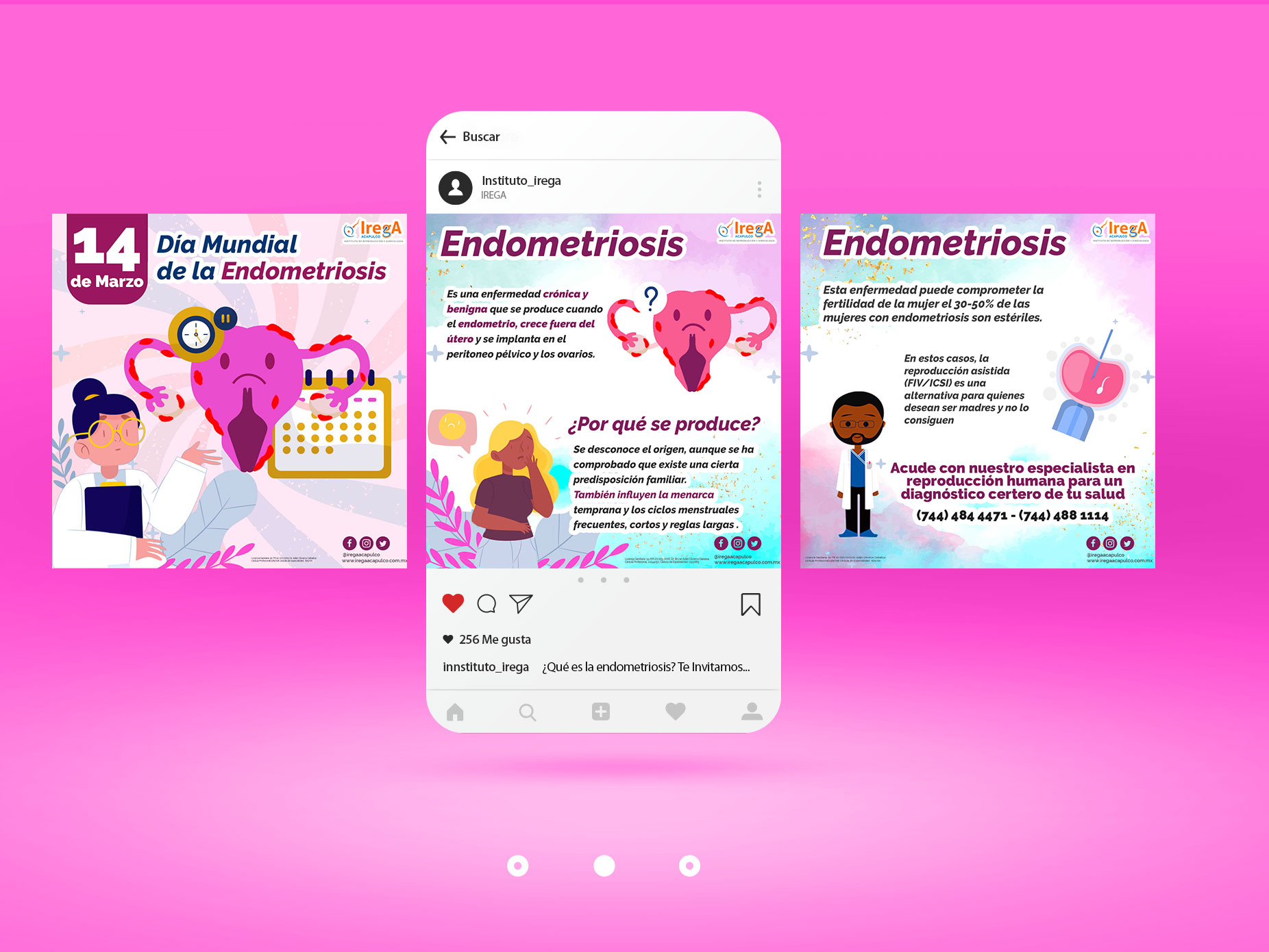 diseño de infografia sobre la endometrioses para irega acapulco
